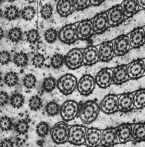An electron micrograph showing a cross section through the ciliary field of a protozoan
